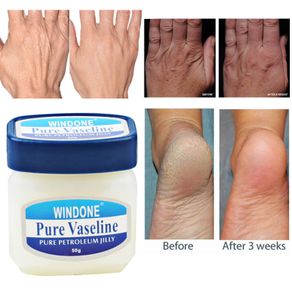 Original Vaseline PURE SKIN JELLY moisturizing cream anti freeze