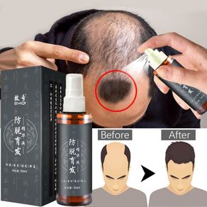生发液⭐Hair Tonic Fast Hair Growth Serum Spray Anti-Hair loss Serum Oil Anti-Hair Fall Treatment For Men and Women 100ml