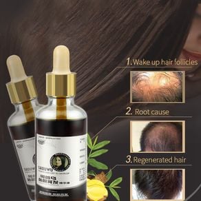 Plant Extract Anti-off Hair Care Fast Hair Growth Dense Regrowth Ginger Serum Oil Anti Loss Treatment Essence Hair Extension