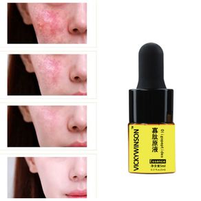 Oligopeptides essence 5ml Stock Solution Whitening Essence Shrink Pores Fade Acne Marks To Acne Essence Skin Care
